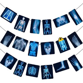 الأشعة الإشعاعية X راي موضوع لافتات الأشعة ديكورات حفلة عيد ميلاد X Ray Party Banner Carlands for Nadiology Doctor Birthday Party X Ray Medical Medical Party Fabry Shower Supplies
