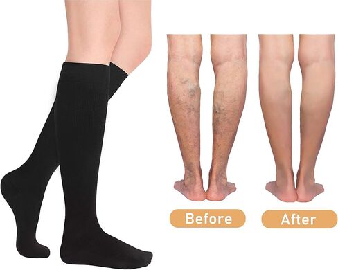 3 أزواج من الجوارب الضاغطة للنساء والرجال الأفضل للجوارب الطبية والتمريضية والجري والسفر. in Kuwait