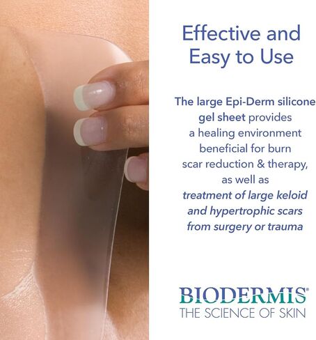 صفائح Epi-Derm الكبيرة، صفائح جل السيليكون للندبات، مثالية للعمليات القيصرية، شد البطن، ندبات استئصال الرحم وجراحة القلب - صفائح الندبات عالية الجودة، قابلة لإعادة الاستخدام، 11 × 15.75 بوصة - طبيعية in Kuwait