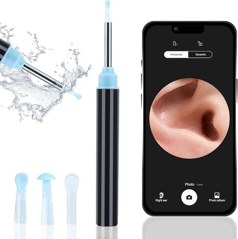 Ear Wax Removal-Ear Wax Removal Tool Camera with Light for Baby Adult,Hall Switch, Waterproof,3 Pcs Ear Set,Ear Cleaner for iOS & Android in Saudi Arabia