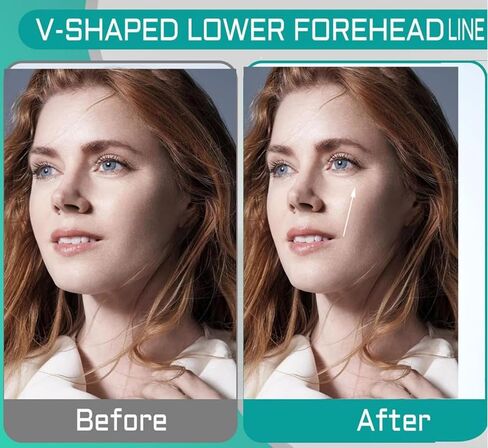 جهاز تمرين الفك للرجال والنساء - 6 قطع من السيليكون القوي لتدريب الفك وتشكيل وتقوية الوجه، وأقراص تونر الفك، وعلكة مضغ خط الفك، ومزيل تقليل الذقن المزدوج، وأدوات التجميل لمدربي الرقبة in Kuwait