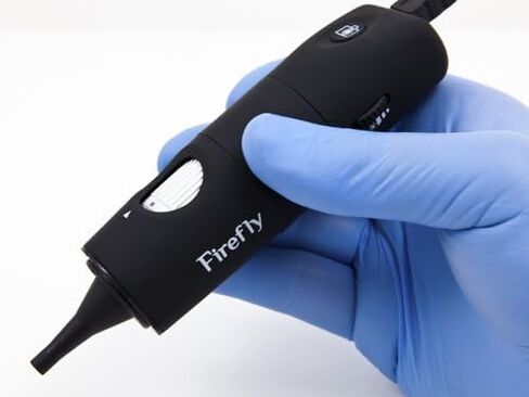 Firefly DE500 Digital Video Otoscope Ear Camera in Saudi Arabia