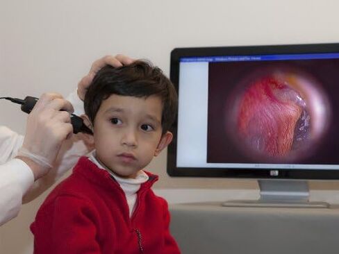 Firefly DE500 Digital Video Otoscope Ear Camera in Saudi Arabia