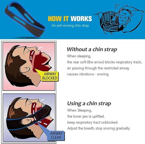 Anti Snoring Chin Strap Anti Snoring Devices Snoring Solution Snore Reducing Sleep Aid to Keep Mouth Closed Adjustable and Breathable Snore Stopper for Men and Women in Kuwait