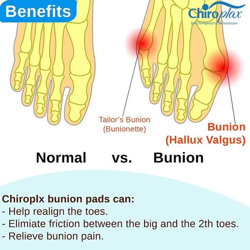 Chiroplax Bunion Corrector Pads Silicone Big Toe Separator Straightener Spacer for Women & Men Hallux Valgus Pain Relief Sleeve Cushion Splint Protector (4 Pads w/Shims - Medium) in Saudi Arabia
