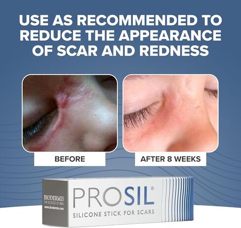 عصا السيليكون للأطفال Pro-SIL 4.25 جرام للندبات من Biodermis in Kuwait