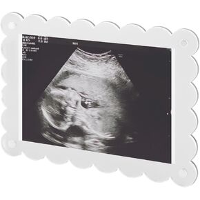 BOXOB Magnetic Scalloped Acrylic Picture Frame, 7.1x5.1 Inch Pregnancy Announcement Photo Frame Keepsake for Gender Reveal Expectant Parents Gift (Transparent)