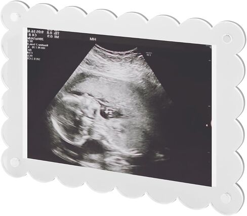 BOXOB Magnetic Scalloped Acrylic Picture Frame, 7.1x5.1 Inch Pregnancy Announcement Photo Frame Keepsake for Gender Reveal Expectant Parents Gift (Transparent) in Saudi Arabia
