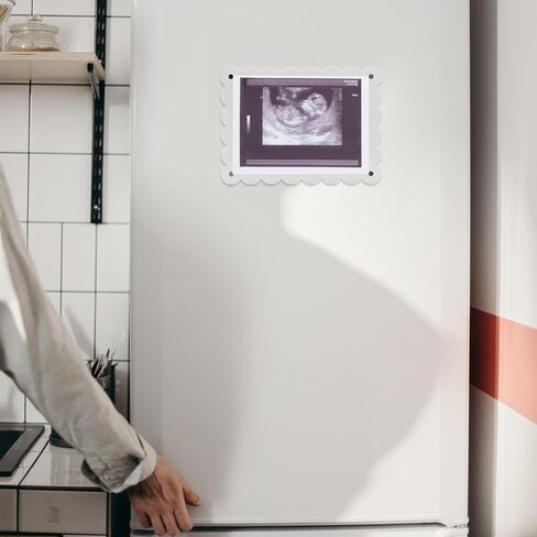BOXOB Magnetic Scalloped Acrylic Picture Frame, 7.1x5.1 Inch Pregnancy Announcement Photo Frame Keepsake for Gender Reveal Expectant Parents Gift (Transparent) in Saudi Arabia
