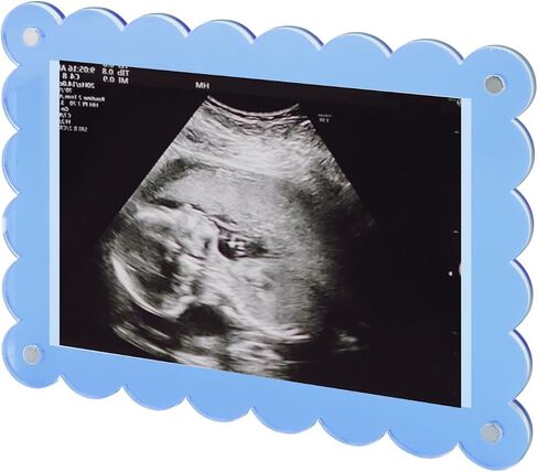 BOXOB Magnetic Scalloped Acrylic Picture Frame, 7.1x5.1 Inch Pregnancy Announcement Photo Frame Keepsake for Gender Reveal Expectant Parents Gift (Transparent) in Saudi Arabia