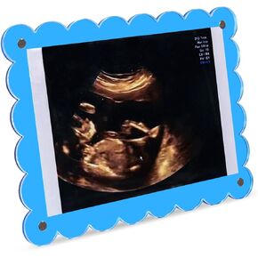 Magnetic Clear Acrylic Scalloped Baby Ultrasound Picture Frame - Sonogram Frame Display for Pregnancy Announcement, Gender Reveal & Expecting Parents Gifts – Ideal for First Time Dad Gifts (Clear)