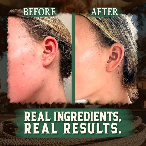 Wrath & Remedy Handmade Whipped Organic Beef Tallow for Skin - 4 OZ (Lavender) — Grass Fed Beef Tallow Moisturizer and Honey Balm for Silky, Sensitive-Skin, Eczema, Rosacea - Free of Harsh Chemicals in Saudi Arabia