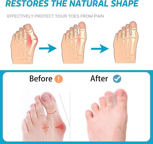 Hammer Toe Straightener Corrector - Bunion Corrector for Women Big Toe, Toe Spacers Toe Separators Toe Splint for Bunion, Curled Toes, Hammertoes (6 Pack,3 Sizes in One Set) in Saudi Arabia