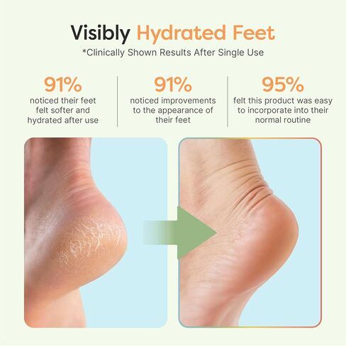 ZenToes Moisturizing Heel Socks 2 Pairs Gel Lined Toeless Spa Socks to Heal and Treat Dry, Cracked Heels While You Sleep (Regular, Gray) in Kuwait