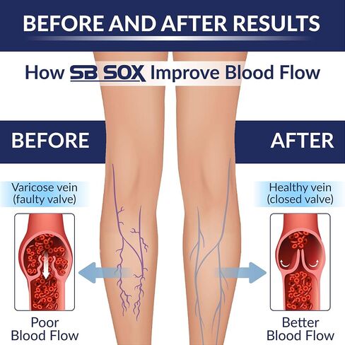 SB SOX 3-Pair Compression Socks for Men & Women (15-20mmHg) – Best Compression Socks for Flying, Medical, Sports, Wide Calf Fit, Skiing, and Daily Wear in Kuwait