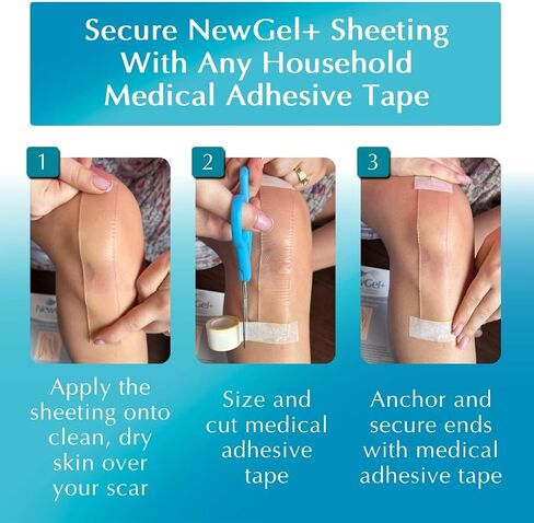 NewGel+ Advanced Silicone Scar Treatment Sheeting for OLD and NEW Scars, for Surgery, Injury, Keloids, C-Section, Burns, and Acne, Reusable, 1" x 6" Sheet (4 Count) - CLEAR in Kuwait