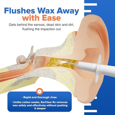 مجموعة تنظيف الأذن من Nuance Medical EarClear Rx - مجموعة رؤوس مرنة مع قلم منظار الأذن وحوض و20 نصيحة للاستعمال مرة واحدة ومنشفة من الألياف الدقيقة in Kuwait