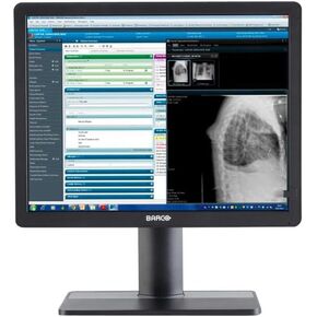 BARCO LED Monitor - 2MP - Color - 21.3" - 1600 x 1200 UXGA - 500 cd/m_ - 1800:1-8 ms - DVI-I, DisplayPort - Black, RAL 9004