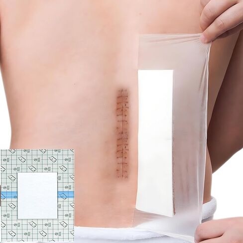 25 Pcs Waterproof Shower Cover 9"x9" with Non-Stick Center Pad for Large Port Surgery Incisions Protector Patch Transparent Film Clear Adhesive Wounds Dressing Bandage Shields in Kuwait