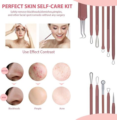 JPNK Blackhead Remover Tool Comedones Extractor Acne Removal Kit for Blemish, Whitehead Popping, 6 Pcs Zit Removing for Nose Face Tools with a Leather Bag in Kuwait