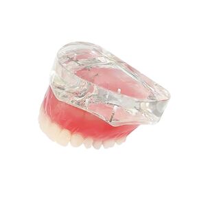Dental Model Overdenture Inferior 4 Implants Demo Mandibular Model for Education and Study(Lower Jaw)