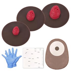Sticky Ileostomy Simulators, Stoma Training Model Set, Multi-Skin Tone Ostomy Care Practice Models for Medical Training and Patient Education - Light