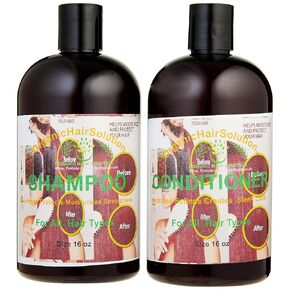 Organic Hair Solution- Conditioner & Shampoo Set -with 100% Pure Aloe vera &Tea Tree-for Itchy and Dry Scalp, Sulfate/Paraben Free -Promotes Hair Growth, Fights Hair Loss & Dandruff for Men & Women