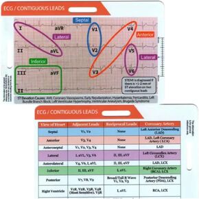 Funny ECG EKG Rhythm Pocket Card,Double Sided Badge Card EKG Telemetry Interpretation Badge Buddy Nursing Cheat Sheet with EKG Ruler Measurement (D)
