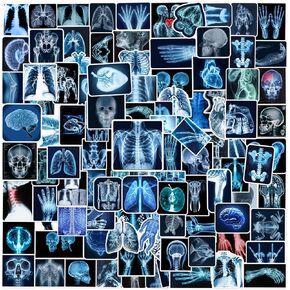 110PCS Radiology X Ray Stickers, Radiology Party Favors Birthday Party Decorations Vinyl Waterproof Stickers for Water Bottle Laptop Luggage Xray Tech Gifts for Teens Boys Girls Adult