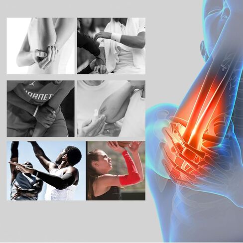 وسادات ركبة سداسية من EULANT / وسادات سداسية للكوع كم ضغط للكرة الطائرة وكرة السلة والبيسبول ومصارعة كرة القدم وركوب الدراجات والجري ورفع الأثقال وجميع الرياضات التي تلامس، مقاسات الشباب والكبار، عبوتان in Kuwait