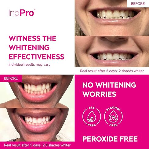 InoPro Teeth Whitening Strips - Peroxide Free Whitening Strips - Whitening Without The Harm - Deep Stains Removal - Whitening for Sensitive Teeth - 14 Treatments, 28 Strips in Kuwait