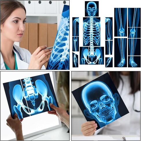 16 Pieces Human X Rays Bones X Rays Human Xrays for Kids Human Bones Body Display Play Table, Black and White in Saudi Arabia