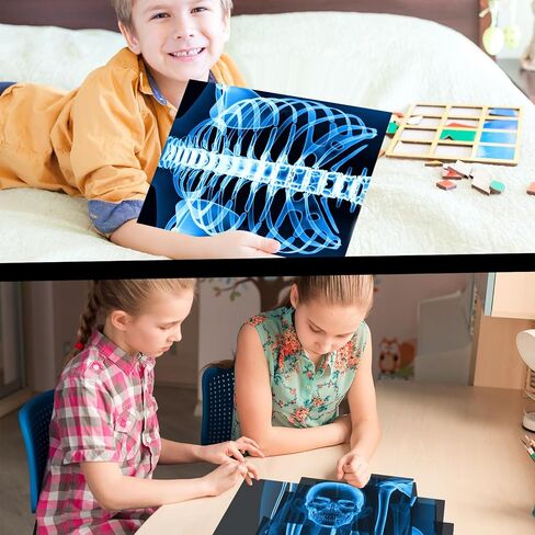 16 Pieces Human X Rays Bones X Rays Human Xrays for Kids Human Bones Body Display Play Table, Black and White in Saudi Arabia