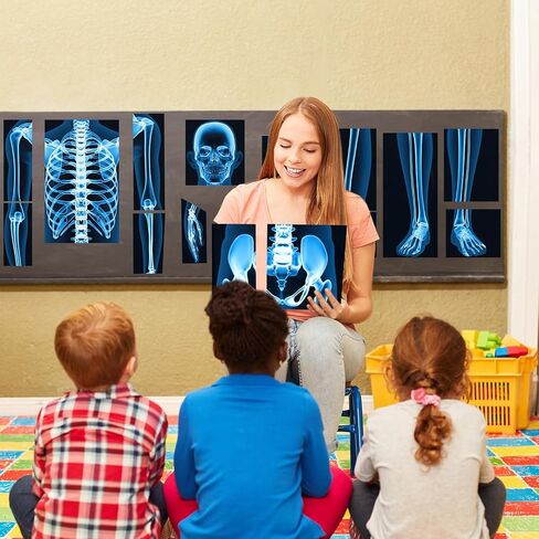 16 Pieces Human X Rays Bones X Rays Human Xrays for Kids Human Bones Body Display Play Table, Black and White in Saudi Arabia