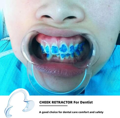 Dental Cheek Retractor Mouth Opener for Teeth Whitening C-Shape Kids Lip Smile Stretcher for Adult Play Blue(6PCS Size S,M,L) in Kuwait