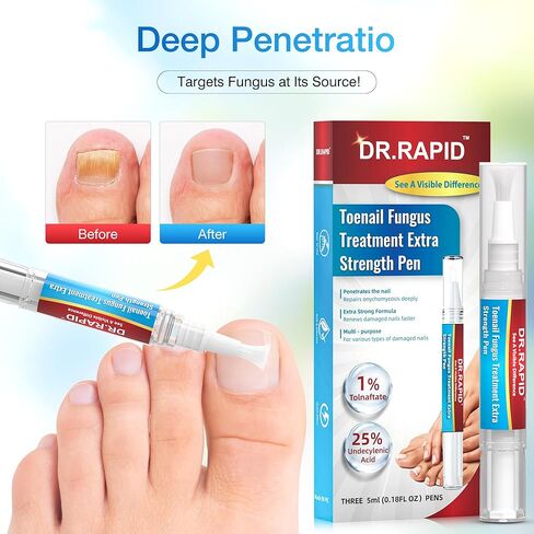 Toenail Fungus Treatment Extra Strength - Fungi Nail Pen Antifungal Repair for Damaged Nails, Fast-Acting Solution for Toe & Fingernail Fungi, Ideal for Nail Health Concerns Athletes 5ml/0.18FLOZ 3Pcs in Kuwait
