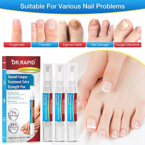 Toenail Fungus Treatment Extra Strength - Fungi Nail Pen Antifungal Repair for Damaged Nails, Fast-Acting Solution for Toe & Fingernail Fungi, Ideal for Nail Health Concerns Athletes 5ml/0.18FLOZ 3Pcs in Kuwait