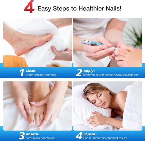 Toenail Fungus Treatment Extra Strength - Fungi Nail Pen Antifungal Repair for Damaged Nails, Fast-Acting Solution for Toe & Fingernail Fungi, Ideal for Nail Health Concerns Athletes 5ml/0.18FLOZ 3Pcs in Kuwait