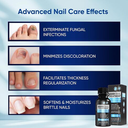 Toenail Fungus Treatment Extra Strength 2pcs x 30ml, Fungus Nail Treatment, Nail Fungus Treatment for Toenail, Toe Nail Fungus Treatment Extra Strength for Damaged and Discoloration Nails. in Saudi Arabia