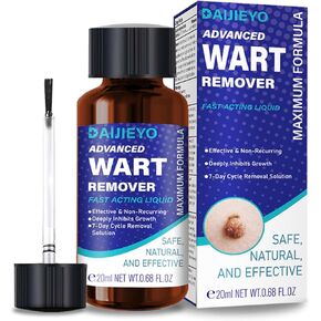 Wart Remover Liquid - Maximum Strength Formula for Rapidly Removing Plantar Warts and Common Warts, Safe, Natural & Potent, Suitable for Most Body Warts