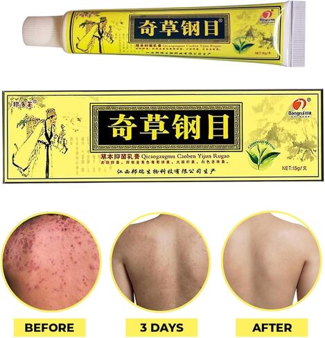 Official Seller - Chinese Herbal Cream - Natural Relief for Skin Issues - Pack of 5 in Kuwait