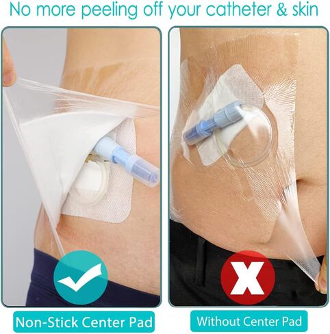 Waterproof Dialysis Catheter Shower Cover | 10x10 Inch Shower Protector with Non-Stick Center Pad | PICC Line Bandage Patch Dressing Wounds Chest Port PD Peritoneal Dialysis Accessories (Pack of 25) in Kuwait