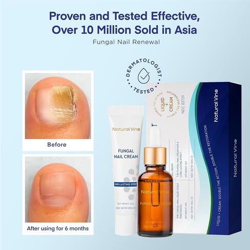 Toenail Fungus Treatment, Nail Fungus Treatment for Toenail, Toe Nail Fungus Treatment Extra Strength, Fungus Nail Treatment, Nail Fungus Treatment for Nail, Fungus Treatment for Fingernails in Saudi Arabia