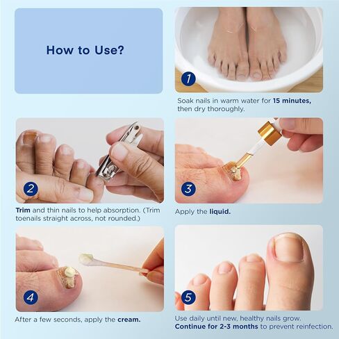 Toenail Fungus Treatment, Nail Fungus Treatment for Toenail, Toe Nail Fungus Treatment Extra Strength, Fungus Nail Treatment, Nail Fungus Treatment for Nail, Fungus Treatment for Fingernails in Saudi Arabia