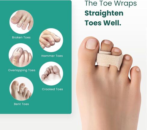 Welnove Hammer Toe Storener - 16 Pack Back Brack Toe - مصحح أصابع القدم المطرقة للنساء - جبول إصبع القدم لأصابع القدم المحصنة ، وأصابع القدم المجهورة ، وأصابع القدم العازمة - (متعدد الحجم ، البيج) in Kuwait