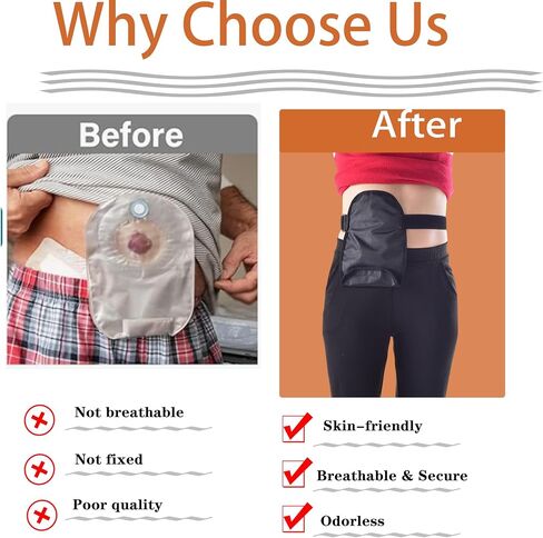 Ostomy Bag Covers Ostomy Belt Stealth Belt Ostomy Bag Cover Adjustable Ostomy Support Belts for Women Men Stoma Urostomy Ileostomy Recover in Kuwait