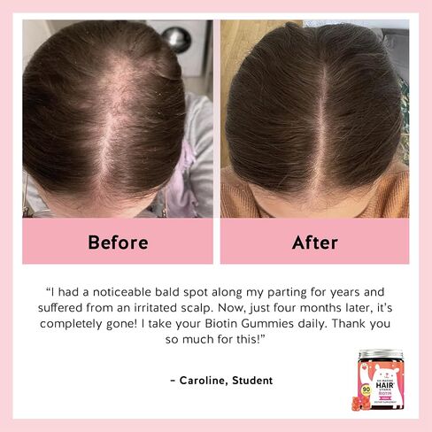 Biotin Gummies for Hair, Skin & Nails. 5,000 mcg High Potency Vegan Vitamins for Faster Hair Growth, Stronger Nails & Healthy Skin. with Vitamins C & E, 30 Gummies in Saudi Arabia