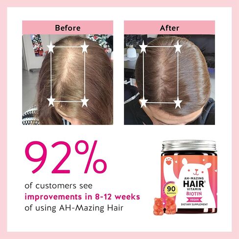 Biotin Gummies for Hair, Skin & Nails. 5,000 mcg High Potency Vegan Vitamins for Faster Hair Growth, Stronger Nails & Healthy Skin. with Vitamins C & E, 30 Gummies in Saudi Arabia