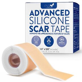 Professional Medical Silicone Scar Treatment Tape | Reusable Waterproof Scar Sheet Roll | Breathable Soft Skin Patch for Surgical, C-Section & Acne Scars (1.6" x 120")