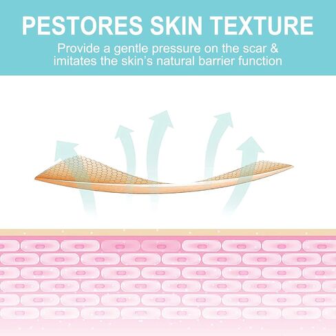 Silicone Scar Sheets (1.6" x 150"-3.8M), Medical Grade Soft Silicone Scar Tape, Scar Strips, Scar Roll - Keloid, C-Section, Surgical, Acne- Scars Removal Treatment, Painless Easy Removal, Reusable in Saudi Arabia